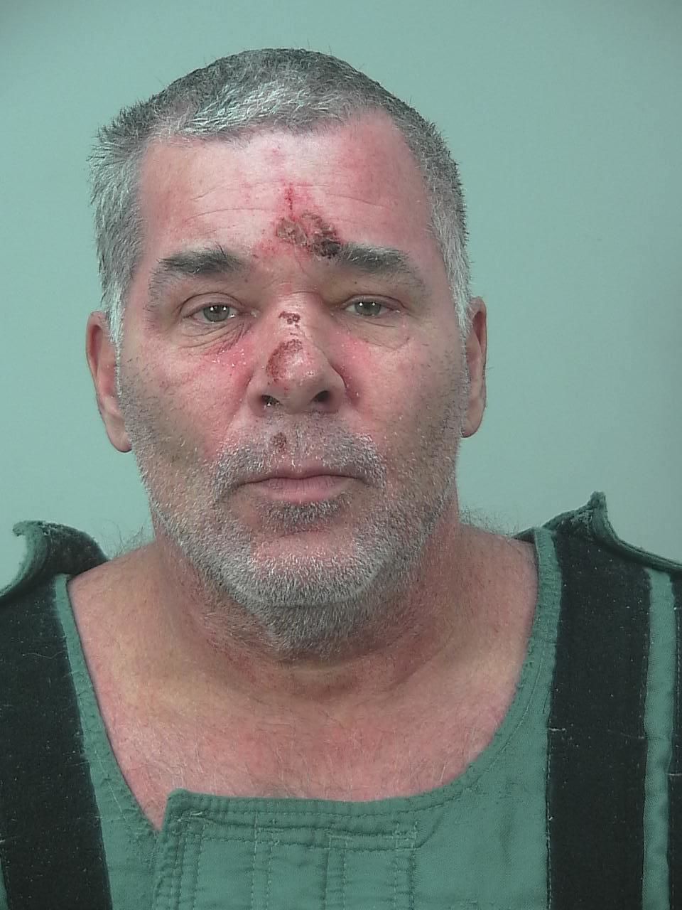 Man kicked in face while relaxing at park, suspect arrested, Madison police say